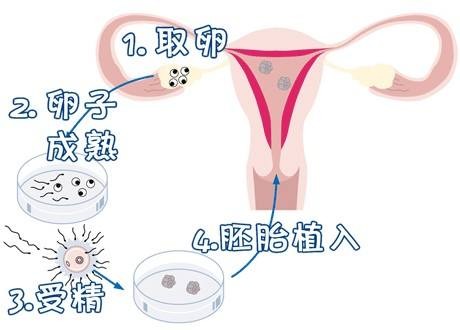怀代生包成功借卵生子